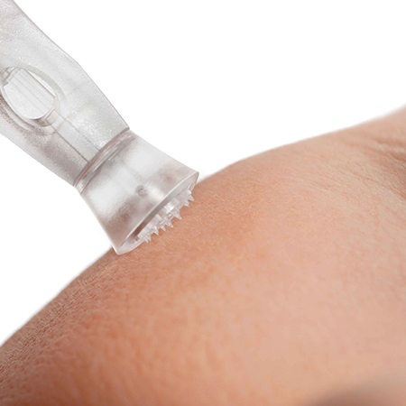 Microneedling mit Ultraschall
